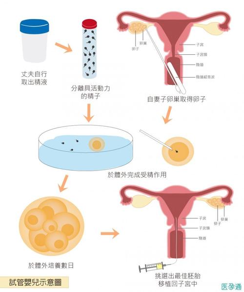 广州试管供卵流程_广州试管供卵流程解析